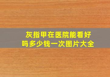 灰指甲在医院能看好吗多少钱一次图片大全