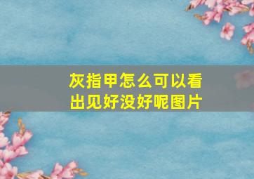 灰指甲怎么可以看出见好没好呢图片