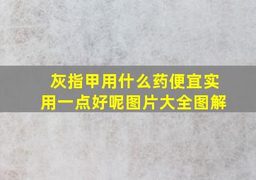 灰指甲用什么药便宜实用一点好呢图片大全图解