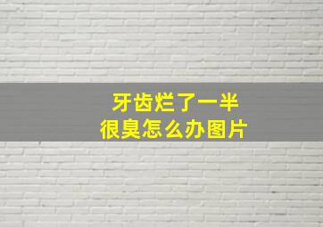 牙齿烂了一半很臭怎么办图片