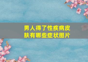 男人得了性疾病皮肤有哪些症状图片