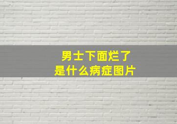 男士下面烂了是什么病症图片