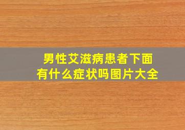 男性艾滋病患者下面有什么症状吗图片大全