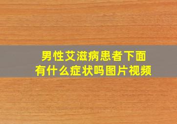 男性艾滋病患者下面有什么症状吗图片视频