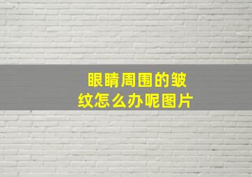 眼睛周围的皱纹怎么办呢图片