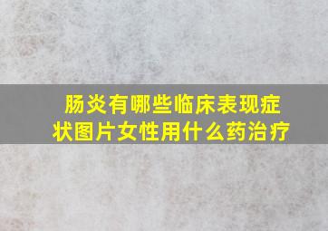 肠炎有哪些临床表现症状图片女性用什么药治疗