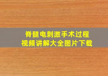 脊髓电刺激手术过程视频讲解大全图片下载