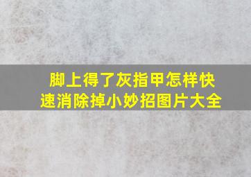 脚上得了灰指甲怎样快速消除掉小妙招图片大全