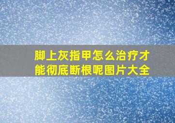 脚上灰指甲怎么治疗才能彻底断根呢图片大全