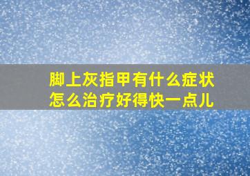 脚上灰指甲有什么症状怎么治疗好得快一点儿