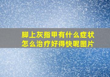 脚上灰指甲有什么症状怎么治疗好得快呢图片