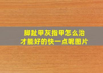 脚趾甲灰指甲怎么治才能好的快一点呢图片