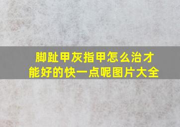 脚趾甲灰指甲怎么治才能好的快一点呢图片大全