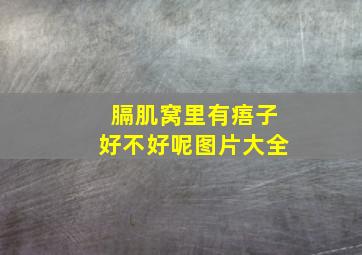 膈肌窝里有痦子好不好呢图片大全